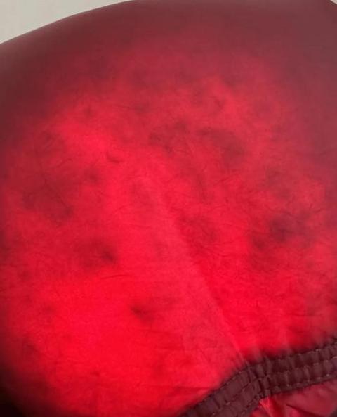 5招轻松应对羽绒服上的502胶渍清理