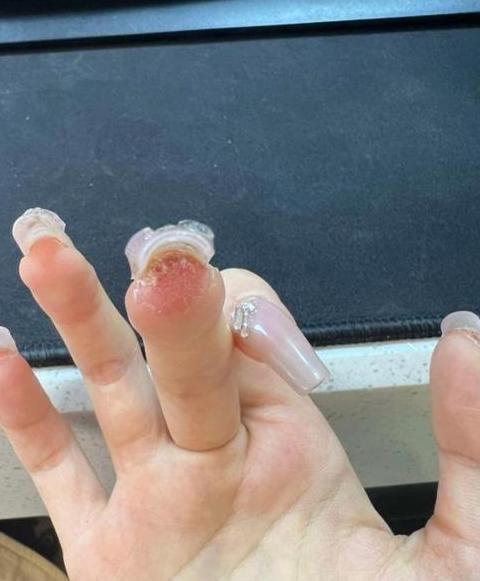 如何处理美甲胶水粘手问题