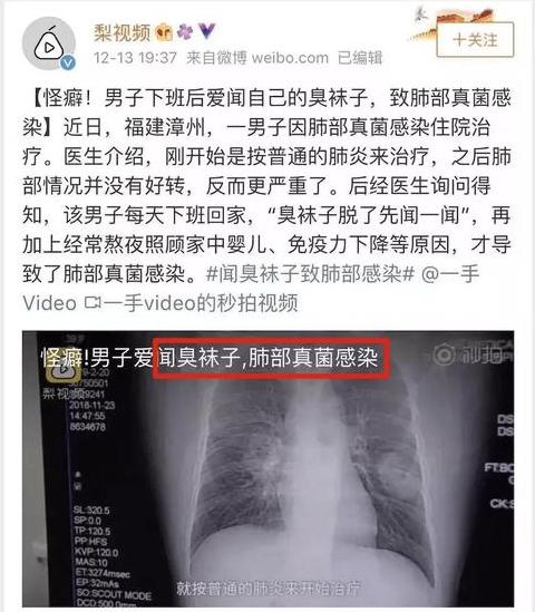 袜子中的细菌和病毒揭秘