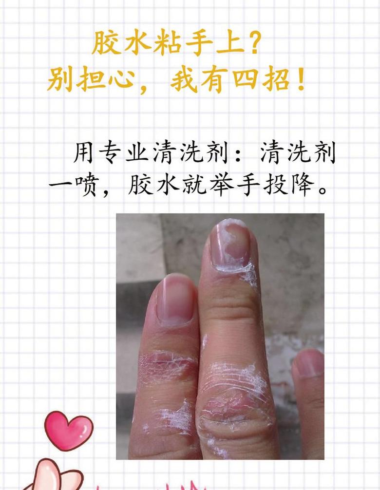 502胶水沾手快速去除攻略