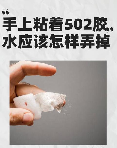 手粘502胶水？5个实用去除方法大公开！