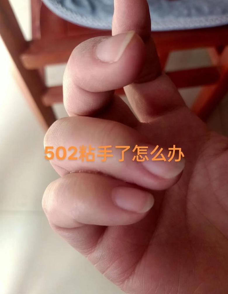 502胶水粘手怎么办？清洗去除攻略
