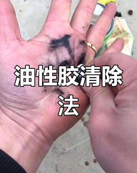 520胶水粘手处理方法大揭秘