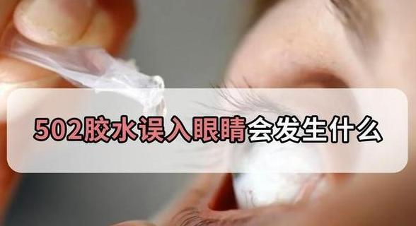 502胶水意外入眼怎么办？快速处理指南